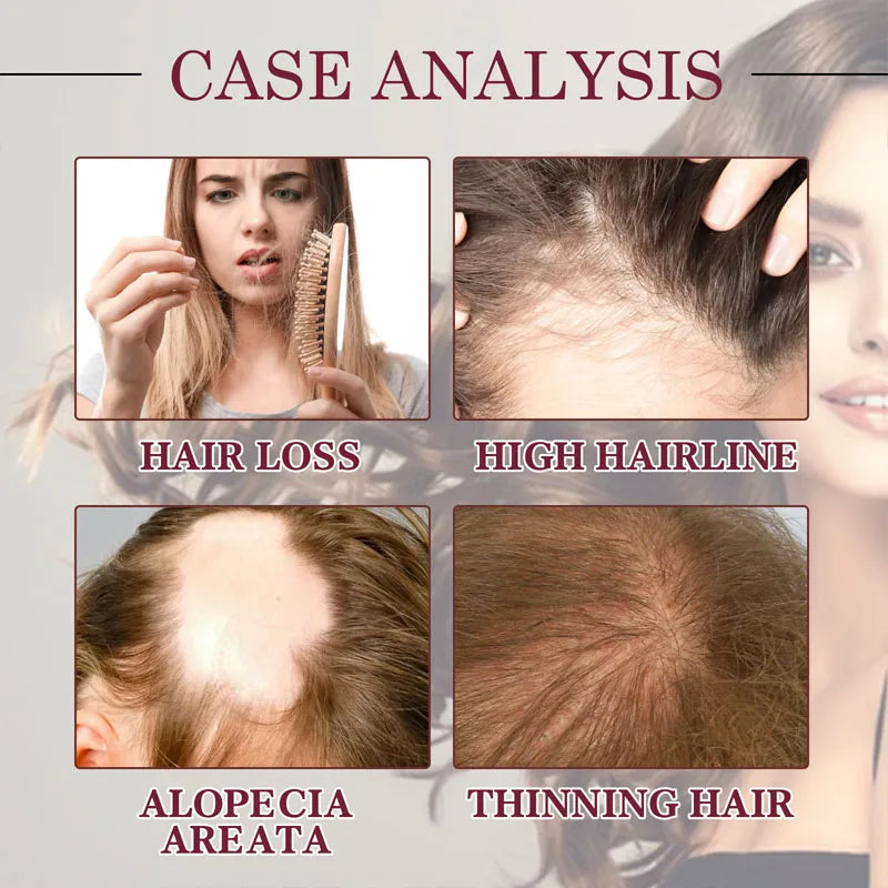 Fast Hair Growth Serum Spray Regrowth Hair Anti Hair Loss Repair Hair Nourish Root Scalp Treatment Essence Hair Care Products