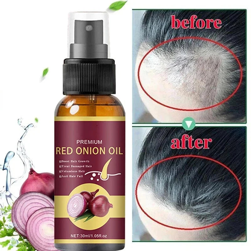 Fast Hair Growth Serum Spray Regrowth Hair Anti Hair Loss Repair Hair Nourish Root Scalp Treatment Essence Hair Care Products