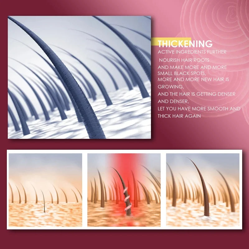 Fast Hair Growth Serum Spray Regrowth Hair Anti Hair Loss Repair Hair Nourish Root Scalp Treatment Essence Hair Care Products